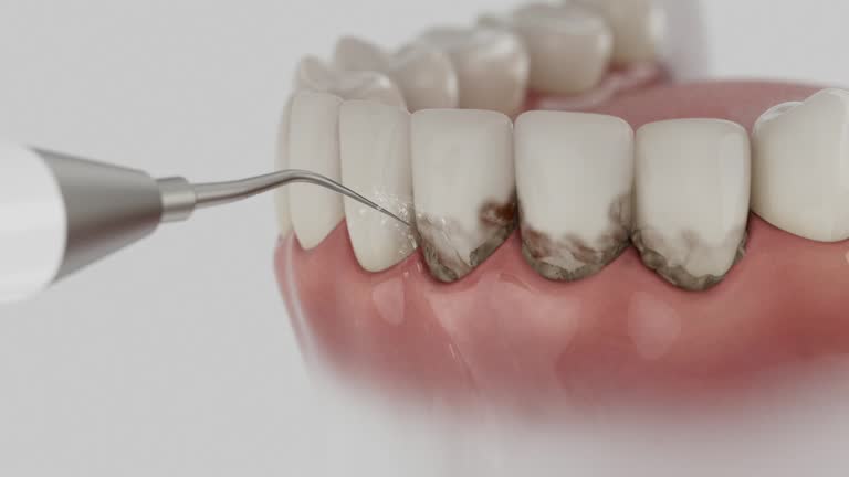 Trusted Dental Crowns And Bridges service in Lewiston, UT - Dentist Open Now